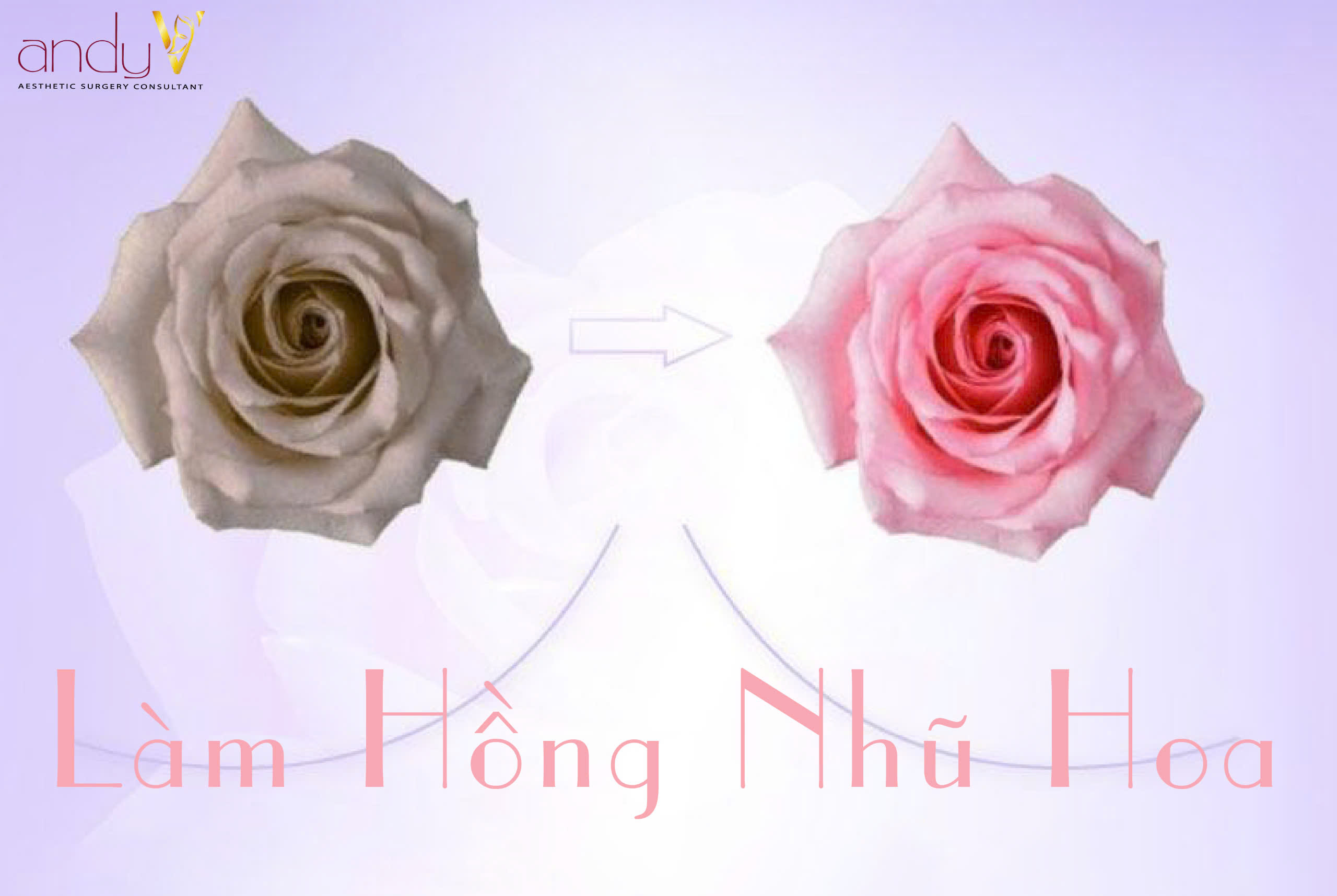 Công nghệ làm hồng nhũ hoa hiện đại