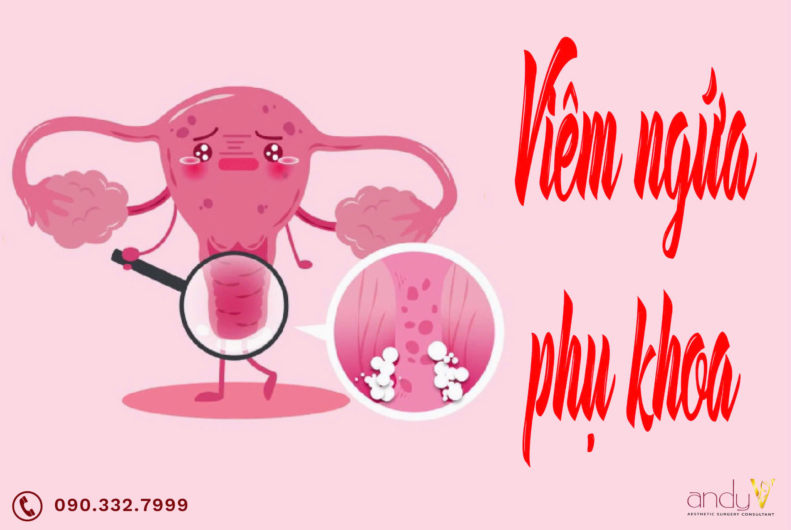 Viêm ngứa phụ khoa