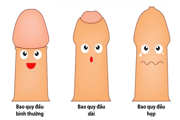 bao quy đầu dài 1