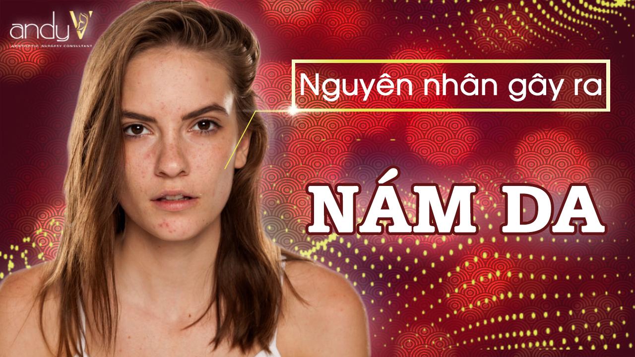 Nguyên nhân chính hình thành nên nám da