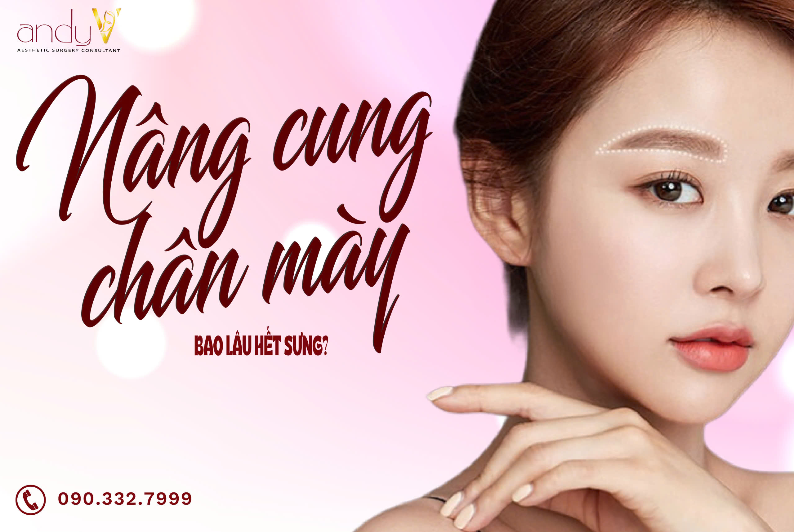 Nâng cung chân mày bao lâu hết sưng?