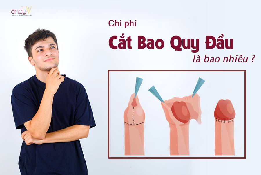 CHI PHÍ CẮT BAO QUY ĐẦU LÀ BAO NHIÊU?