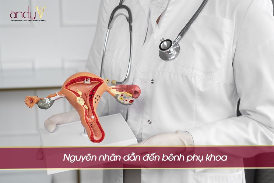 Nguyên nhân dẫn đến bệnh phụ khoa