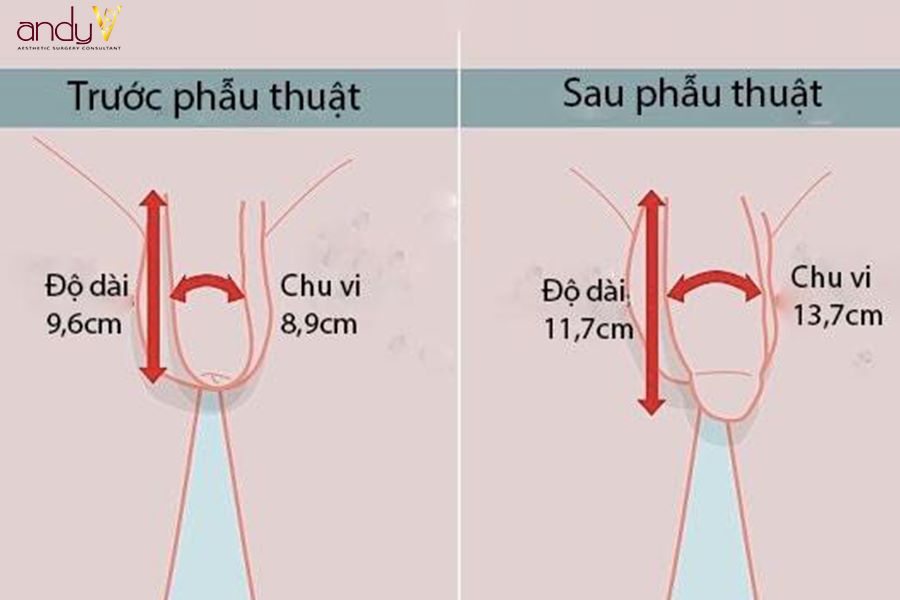 Megaderm tăng size cậu nhỏ có những ưu điểm vượt trội gì?