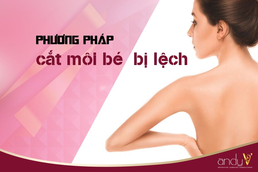 Cắt Môi Bé Bị Lệch - Giải Pháp Hiệu Quả và An Toàn