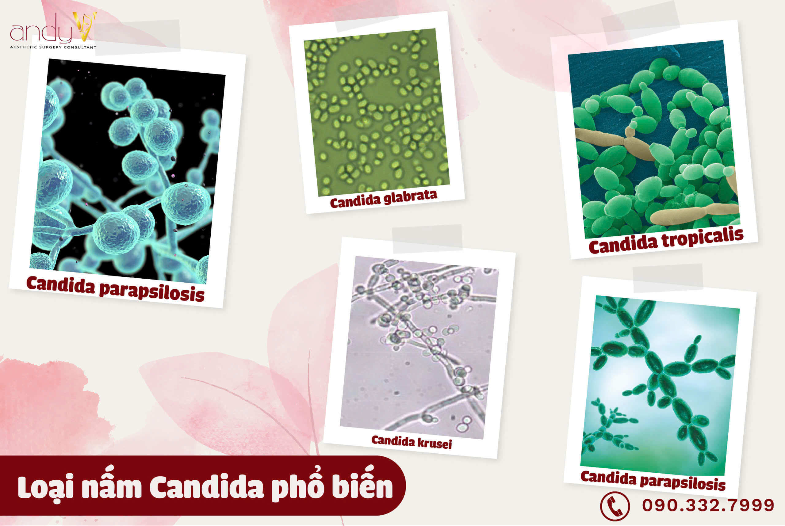 Các loại nấm Candida phổ biến