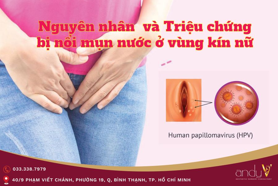 Nguyên nhân bị nổi mụn nước ở vùng kín nữ