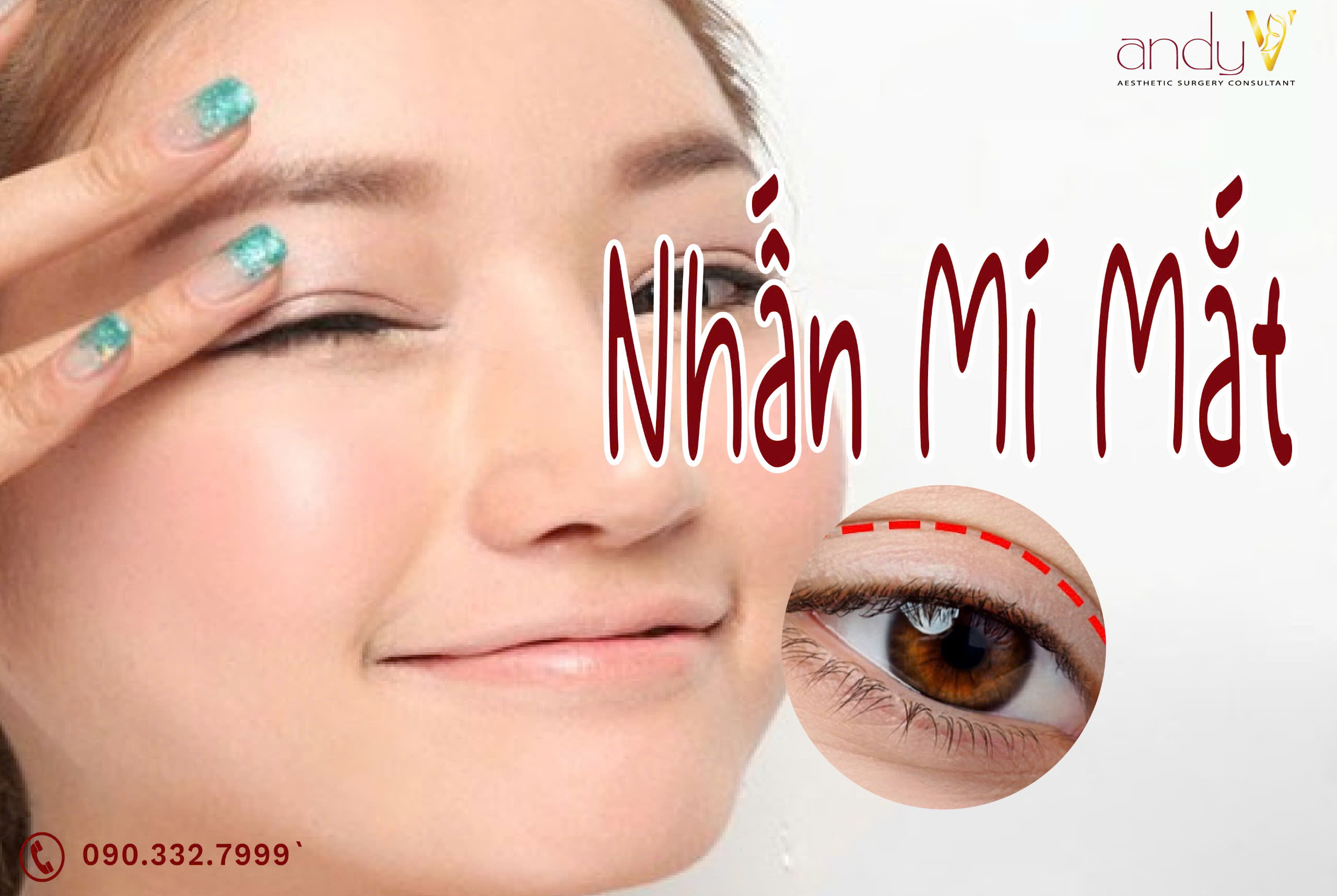 Nhấn mí mắt