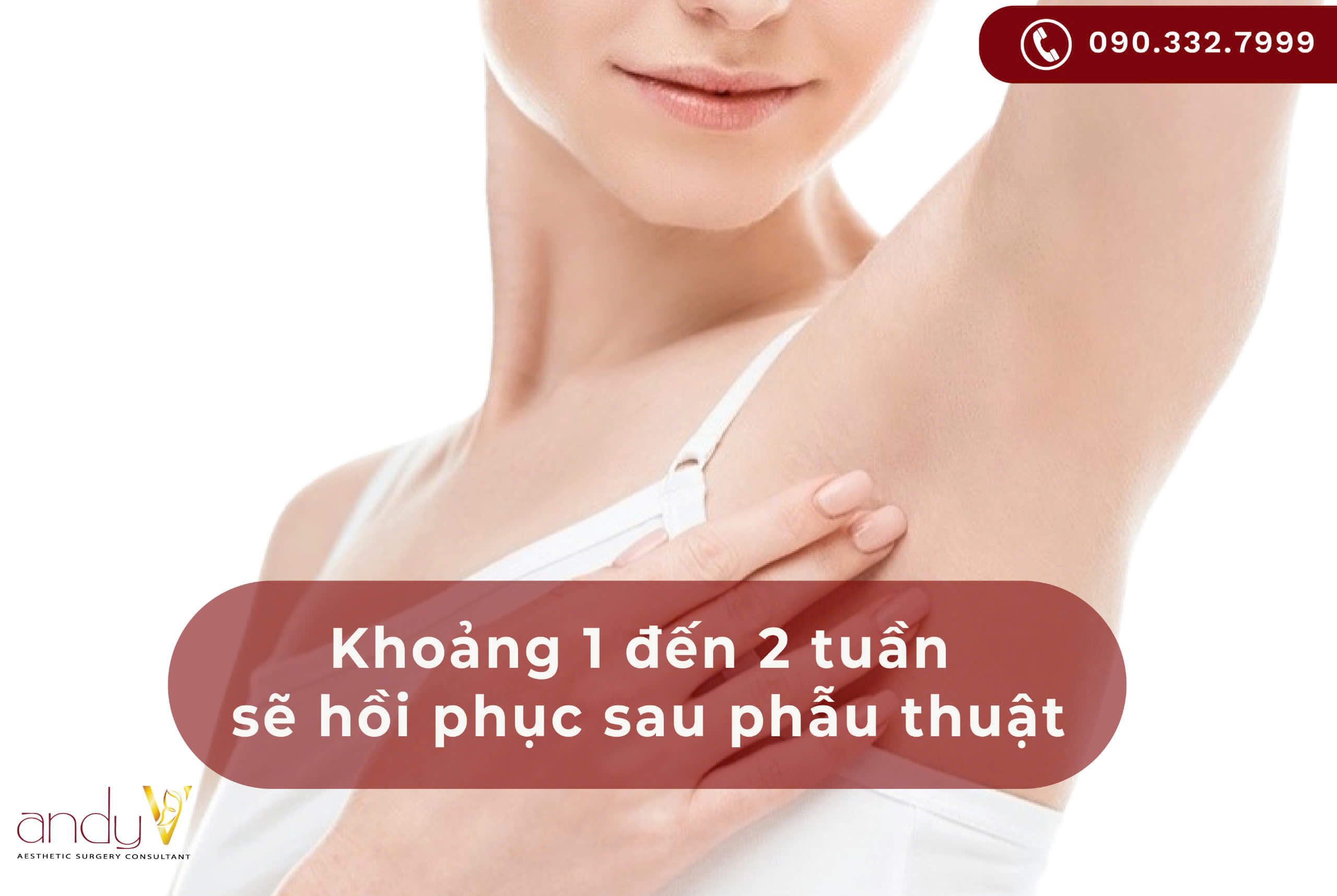 Khoảng 1 đến 2 tuần sẽ hồi phục sau phẫu thuật cắt tuyến mồ hôi nách