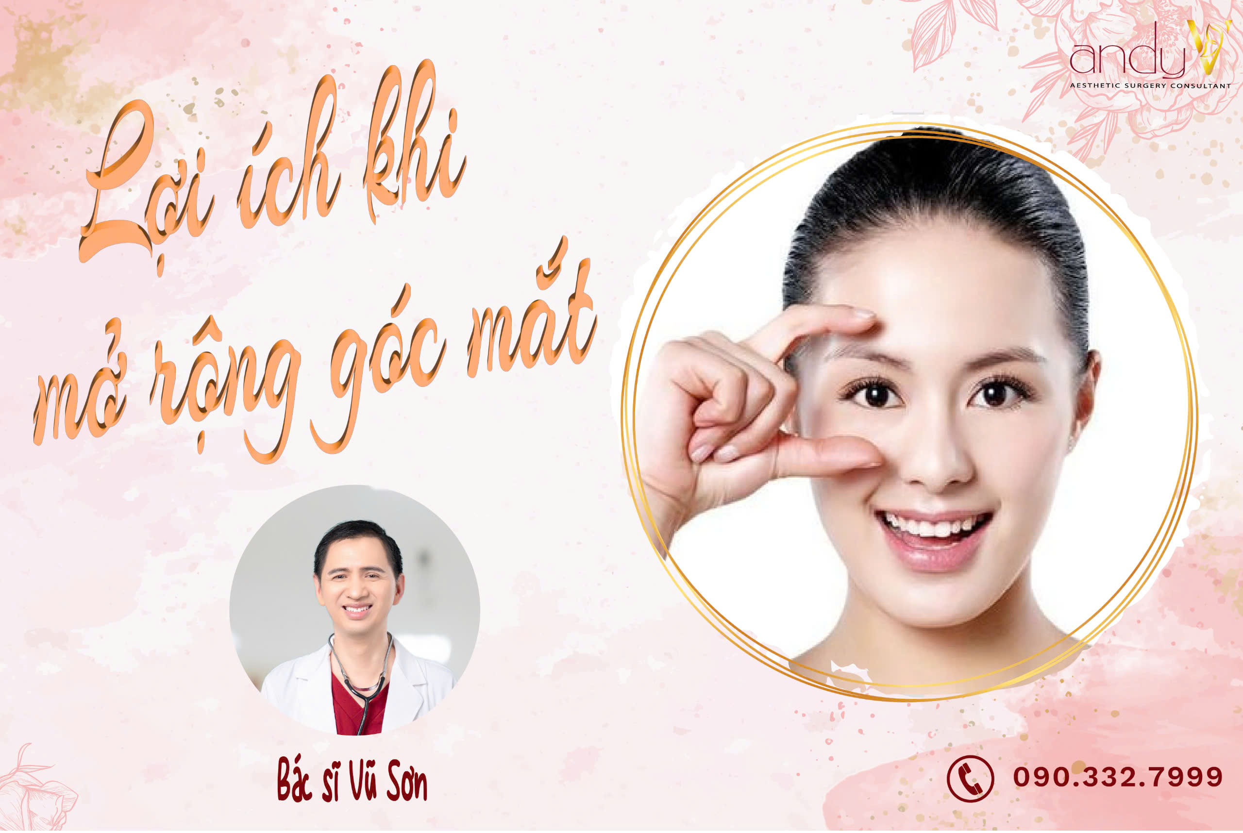 Lợi ích khi mở rộng góc mắt