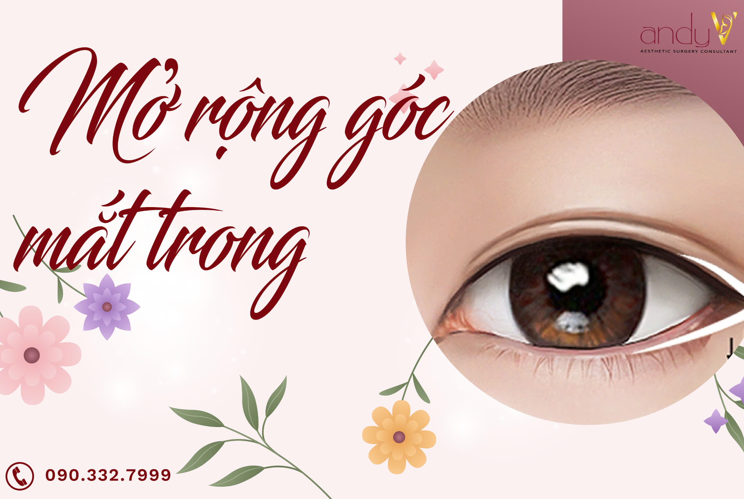 Mở rộng góc mắt trong