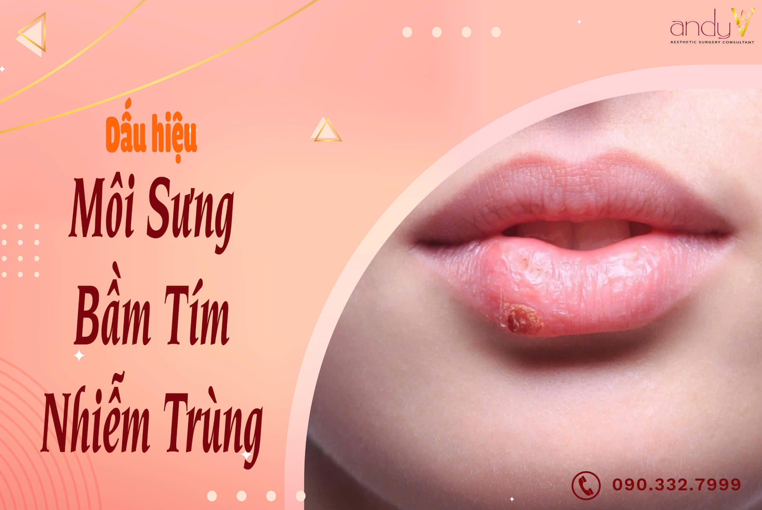 Môi sưng, bầm tím hoặc nhiễm trùng