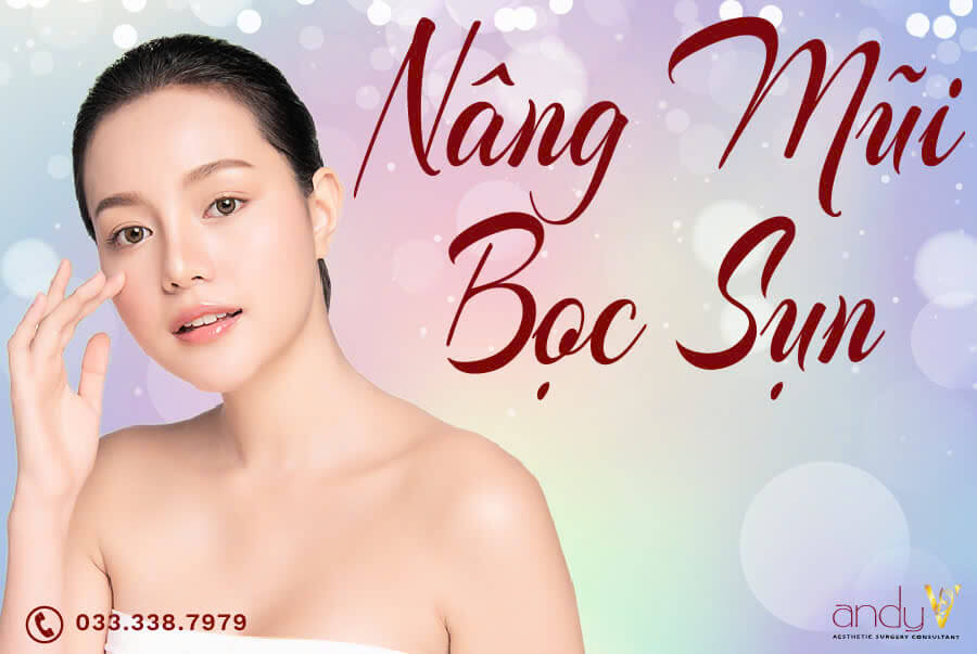 Nâng mũi bọc sụn