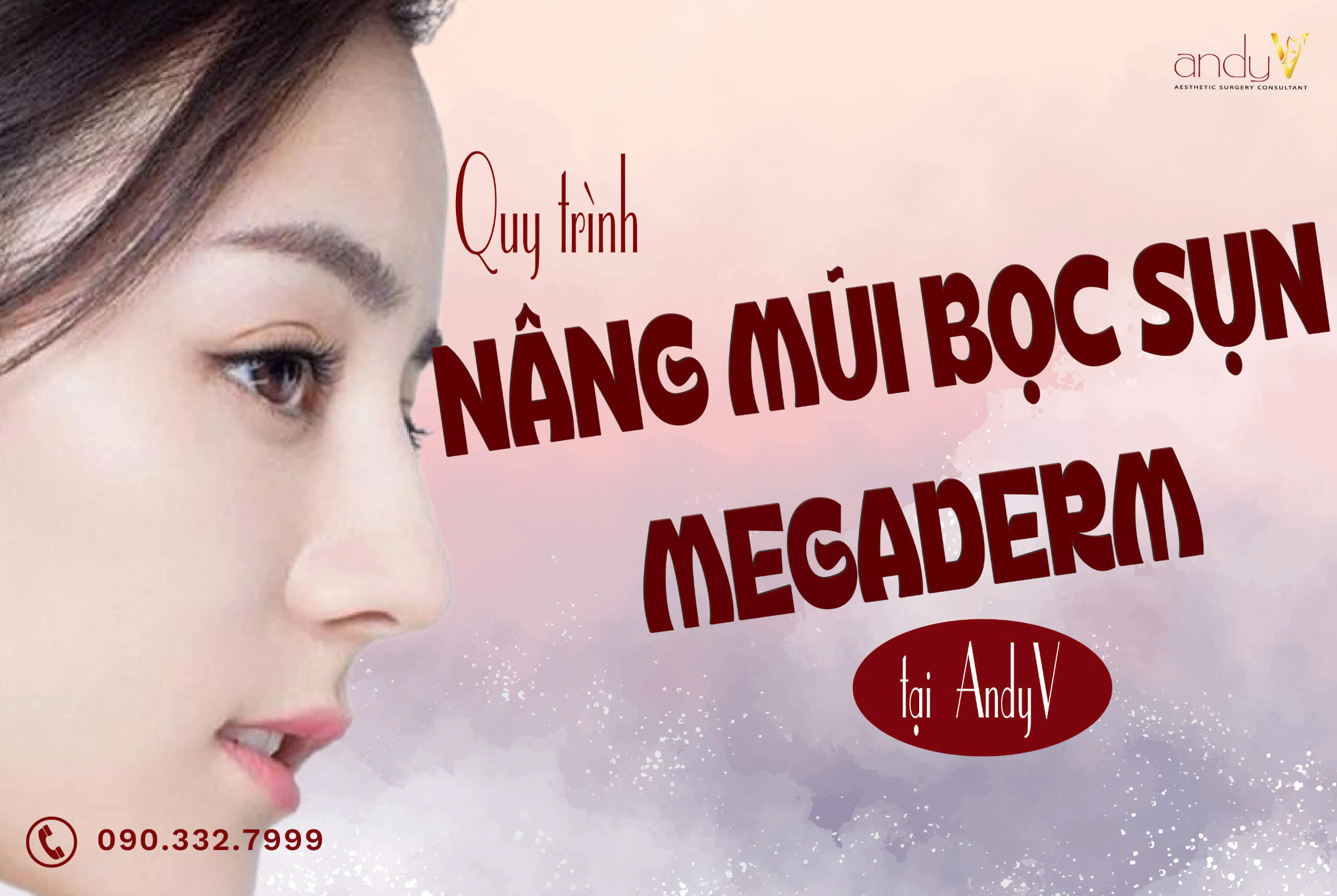 Quy trình nâng mũi bọc sụn Megaderm