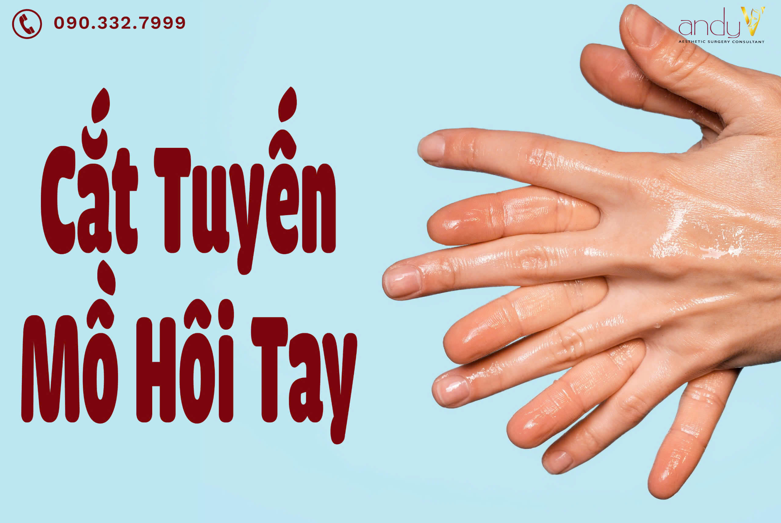 Cắt tuyến mồ hôi tay