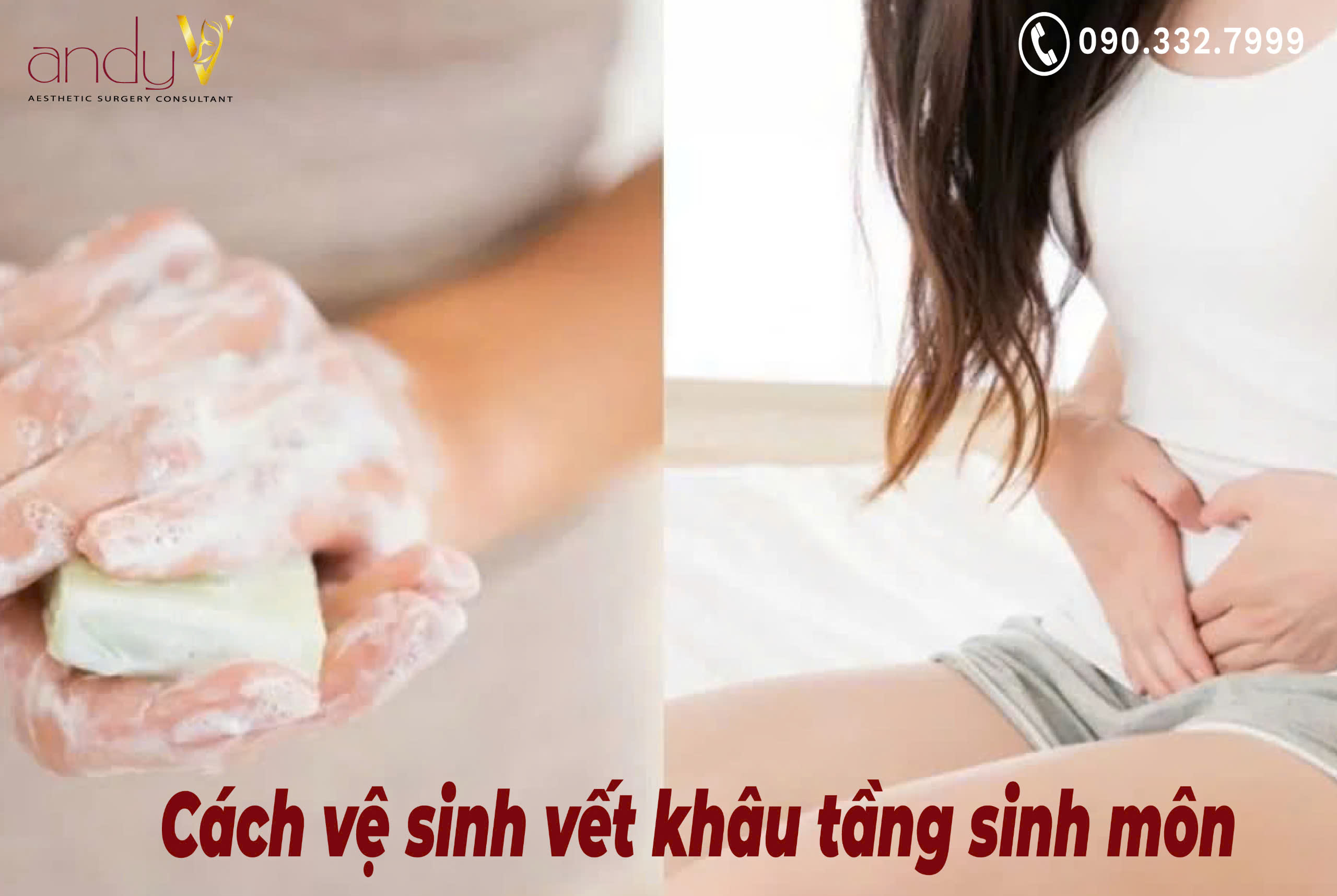 Bí quyết chăm sóc giữ vết khâu tầng sinh môn sạch sẽ, khô thoáng, giảm nguy cơ nhiễm trùng