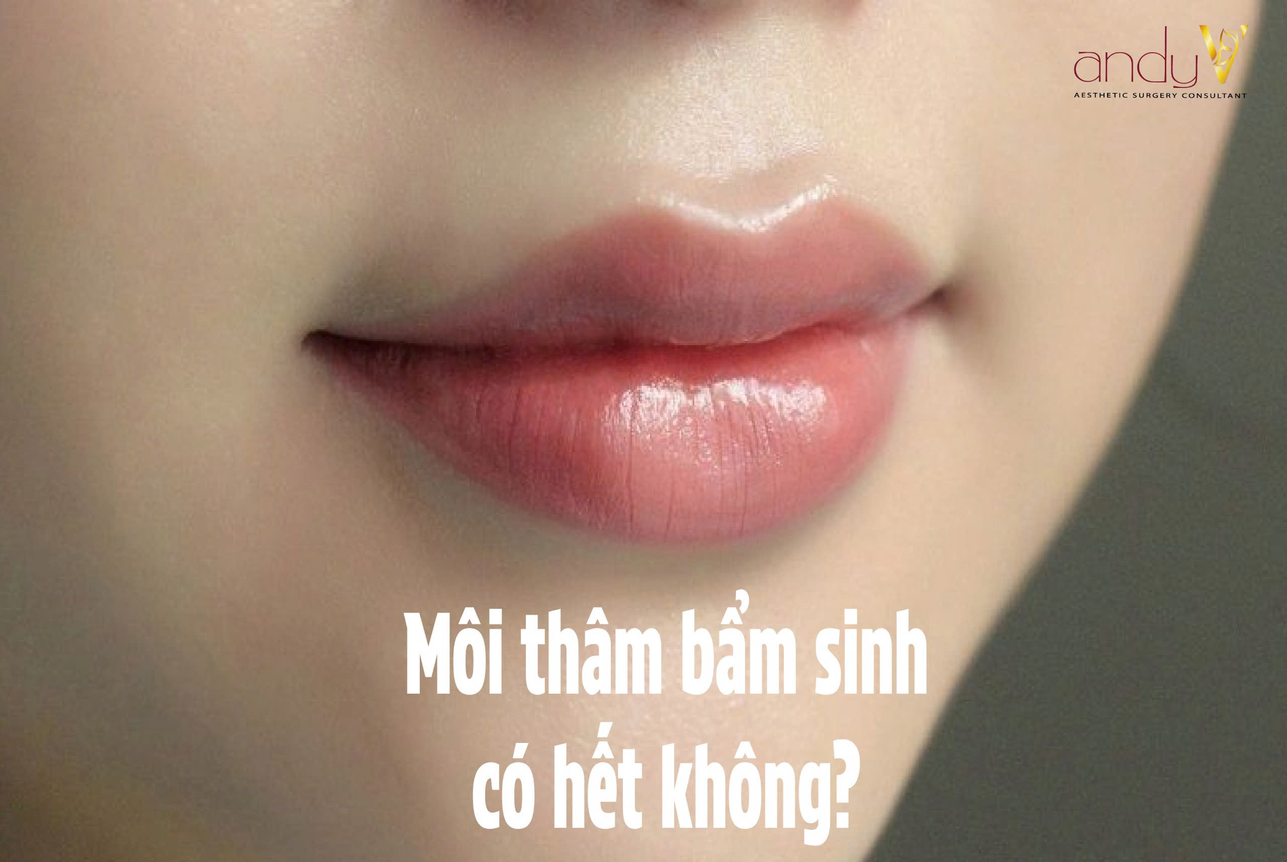 "Môi thâm bẩm sinh có hết không?": Hé lộ bí quyết cho đôi môi hồng hào