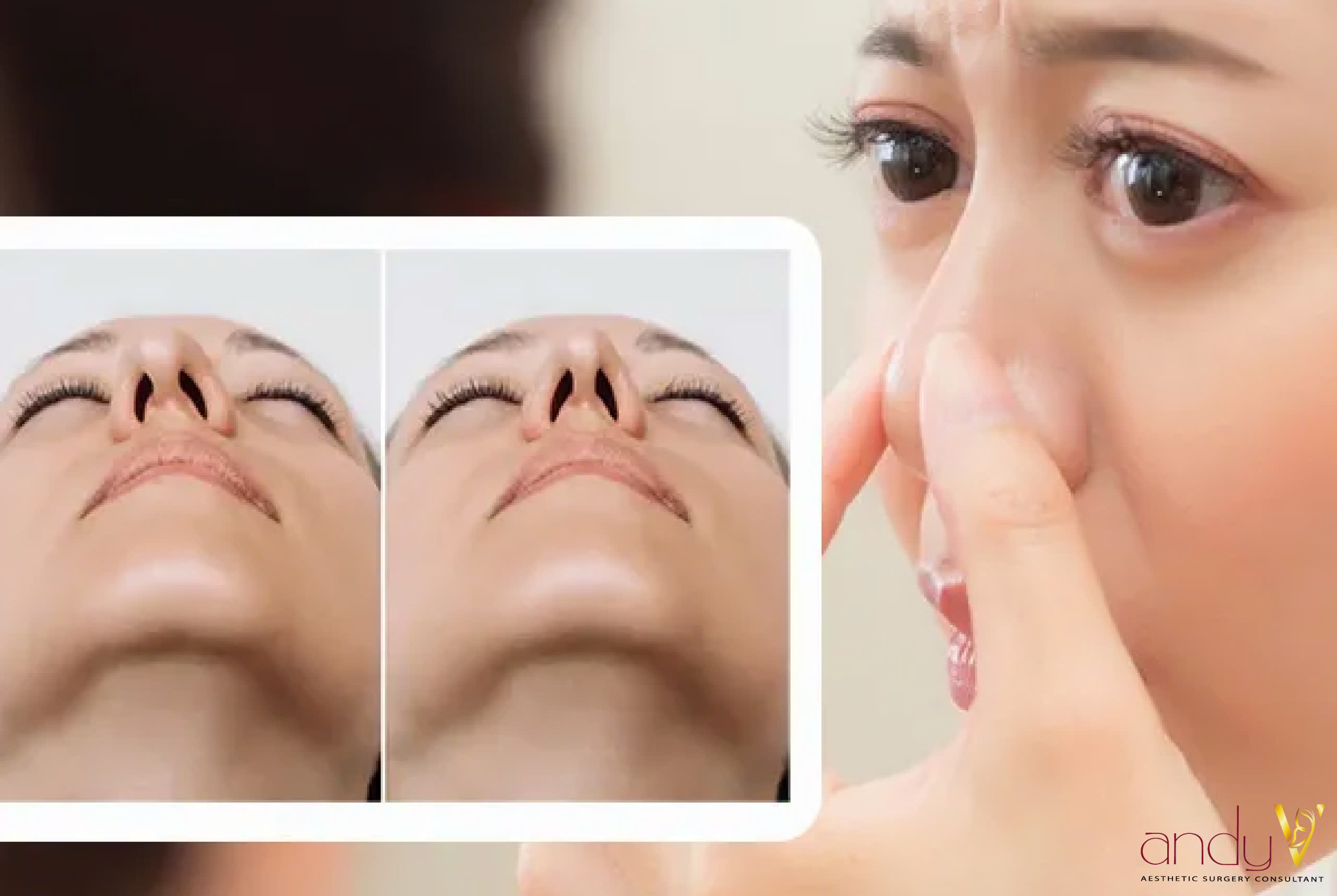 Góc nghiêng tiết lộ dáng mũi lệch