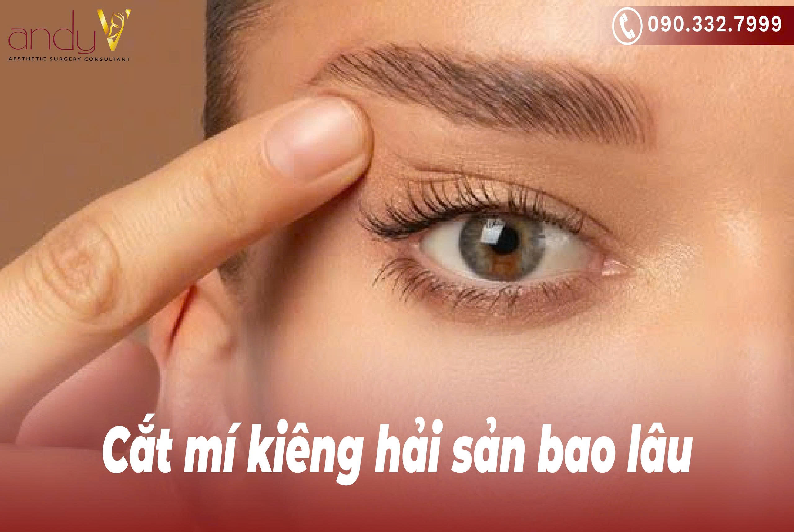 Cắt mí mắt kiêng ăn hải sản trong bao lâu để mau lành?