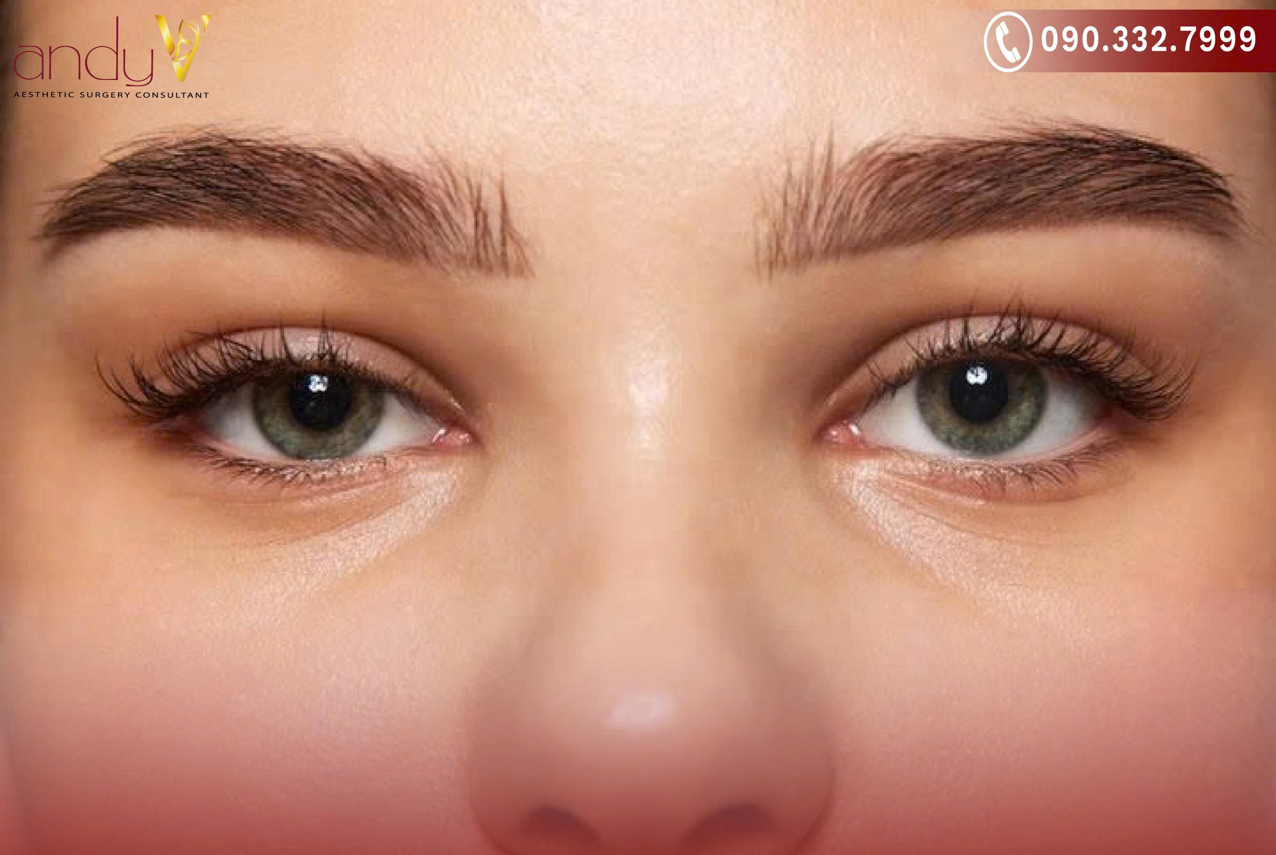 Khám phá ai là người phù hợp nhất để mở góc mắt ngoài