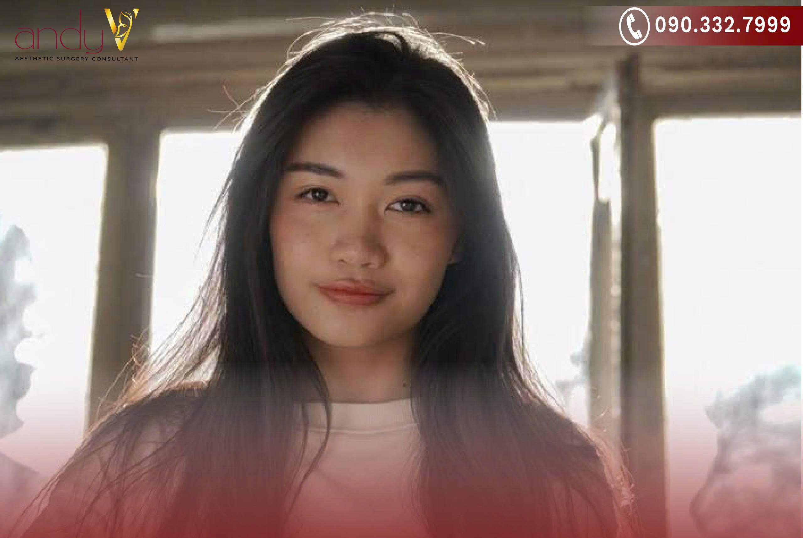 Dáng mũi tẹt thường được coi là kém hài hòa theo tiêu chuẩn thẩm mỹ