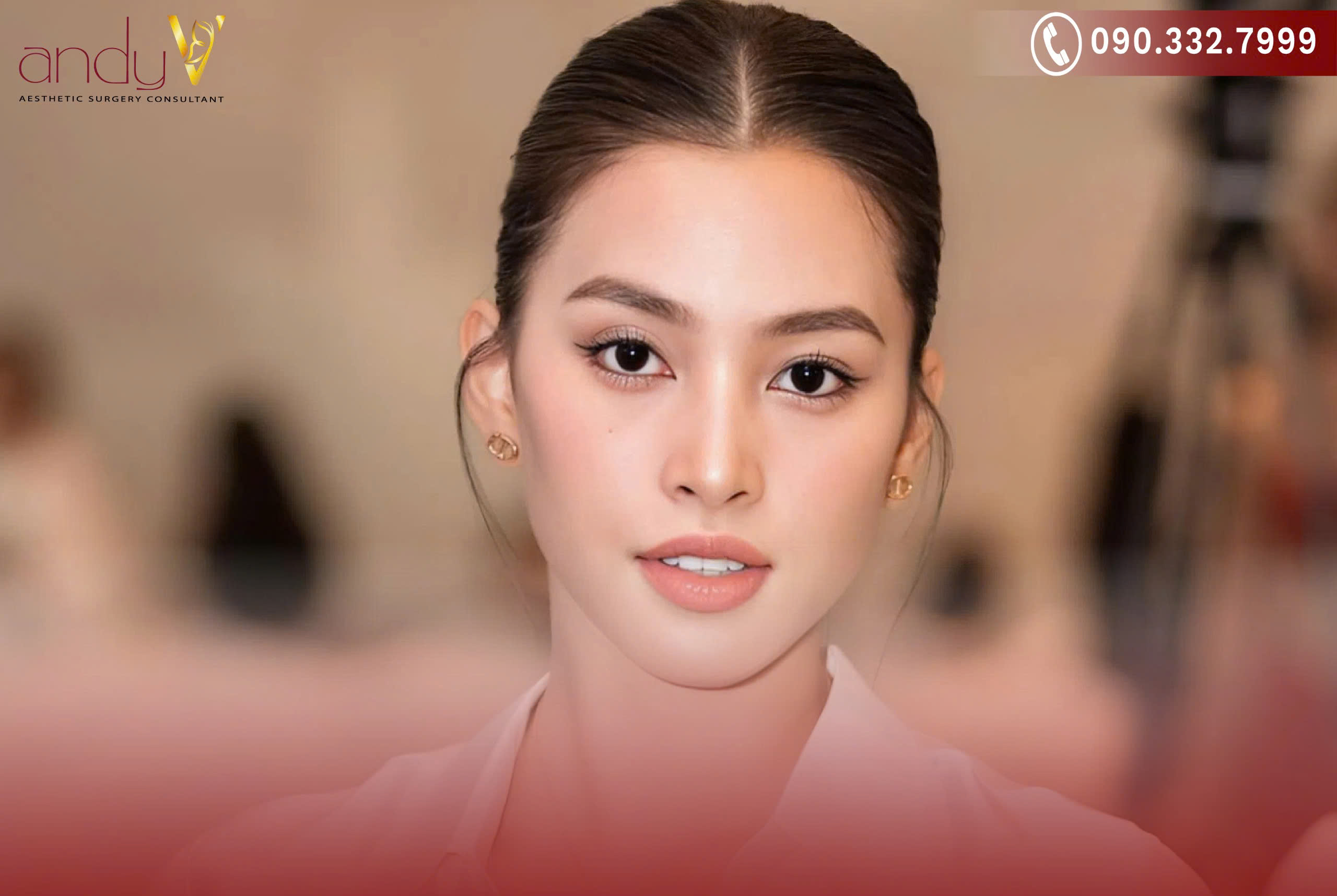 Sống mũi thẳng, không bị gồ ghề hay lõm xuống