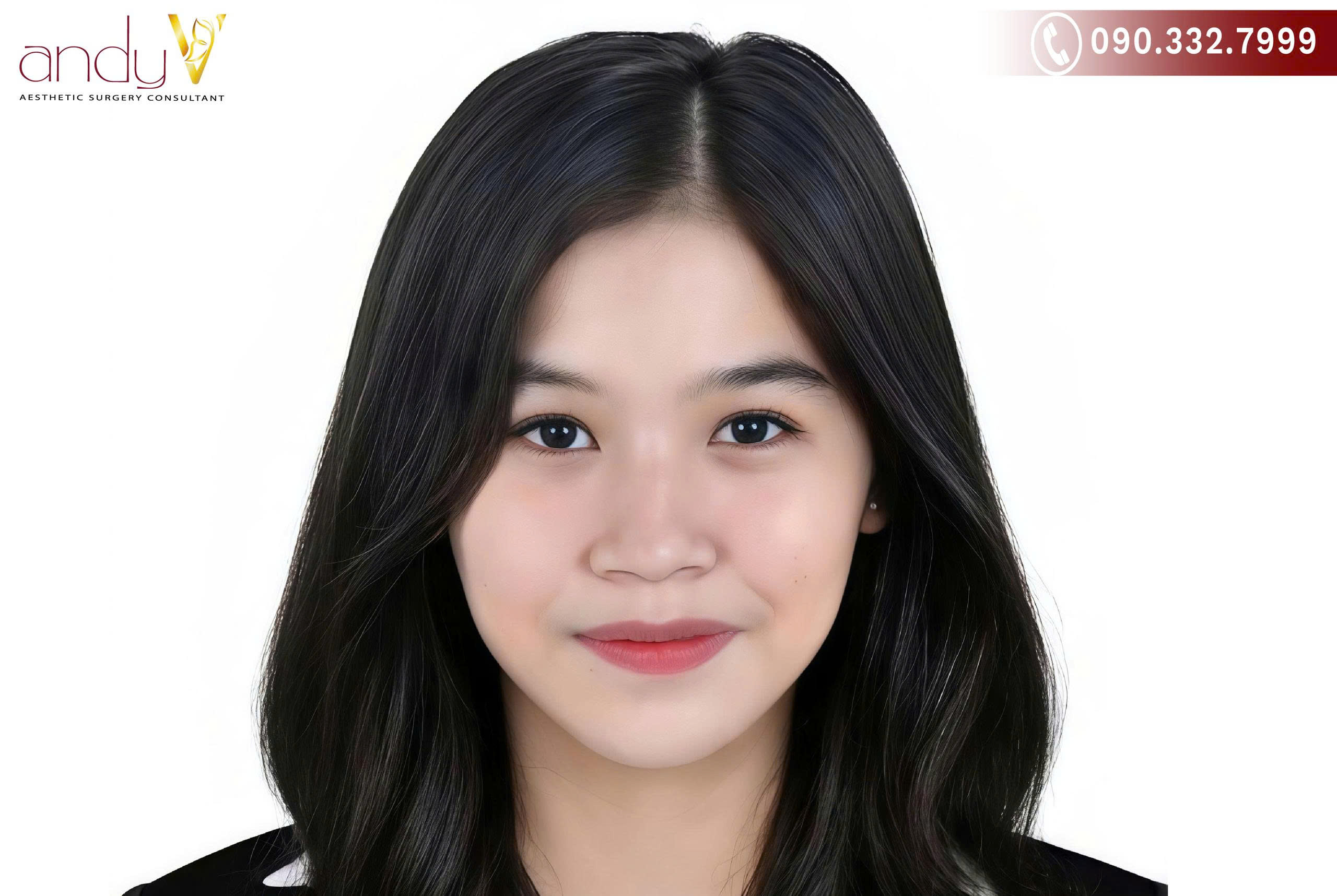 Trong nhân tướng học, mũi tẹt thường được xem là dáng mũi có nhiều điểm hạn chế, đặc biệt liên quan đến đường công danh, tài lộc