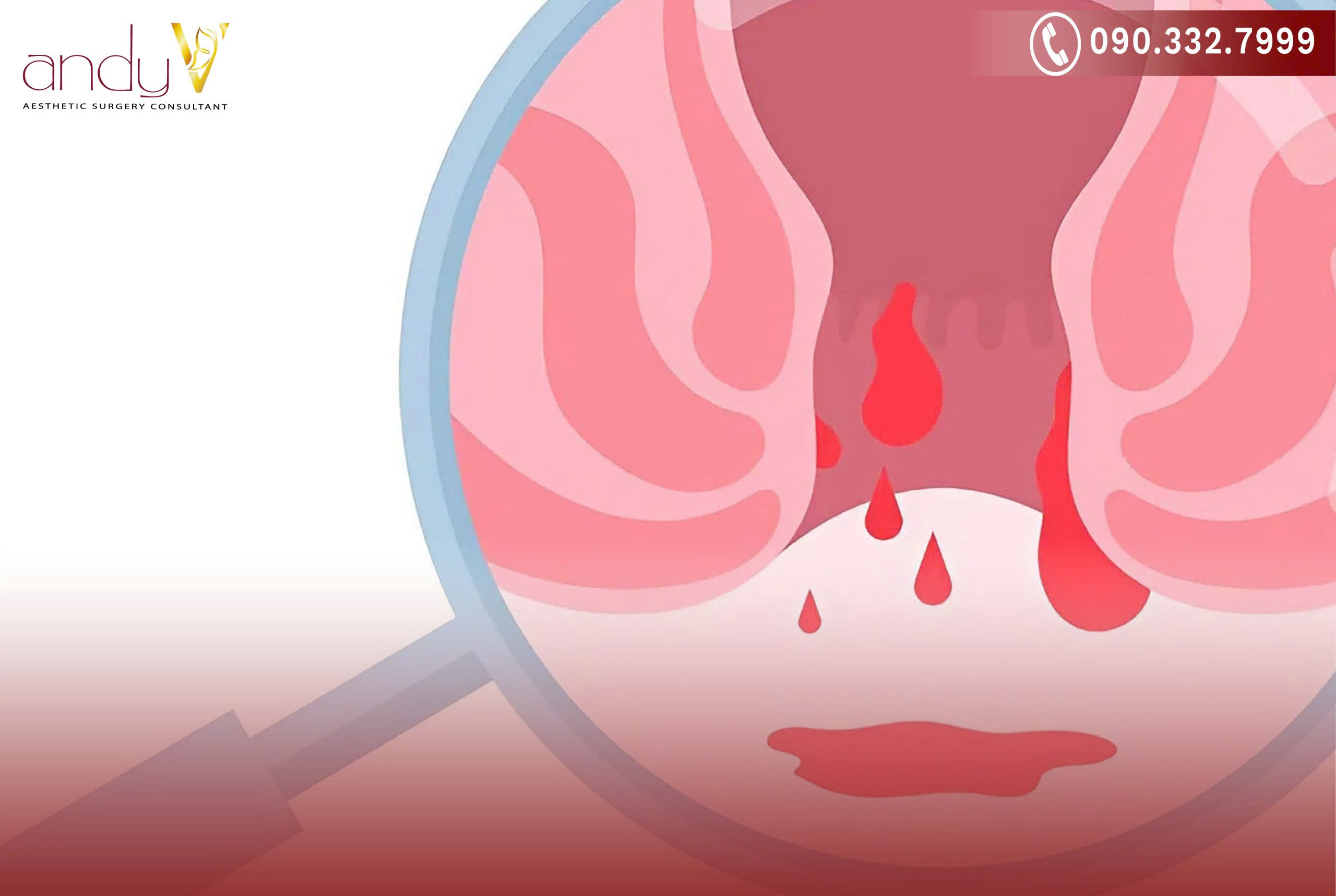 Có hai cách phân loại chính dựa trên thời gian xuất hiện và nguyên nhân gây ra