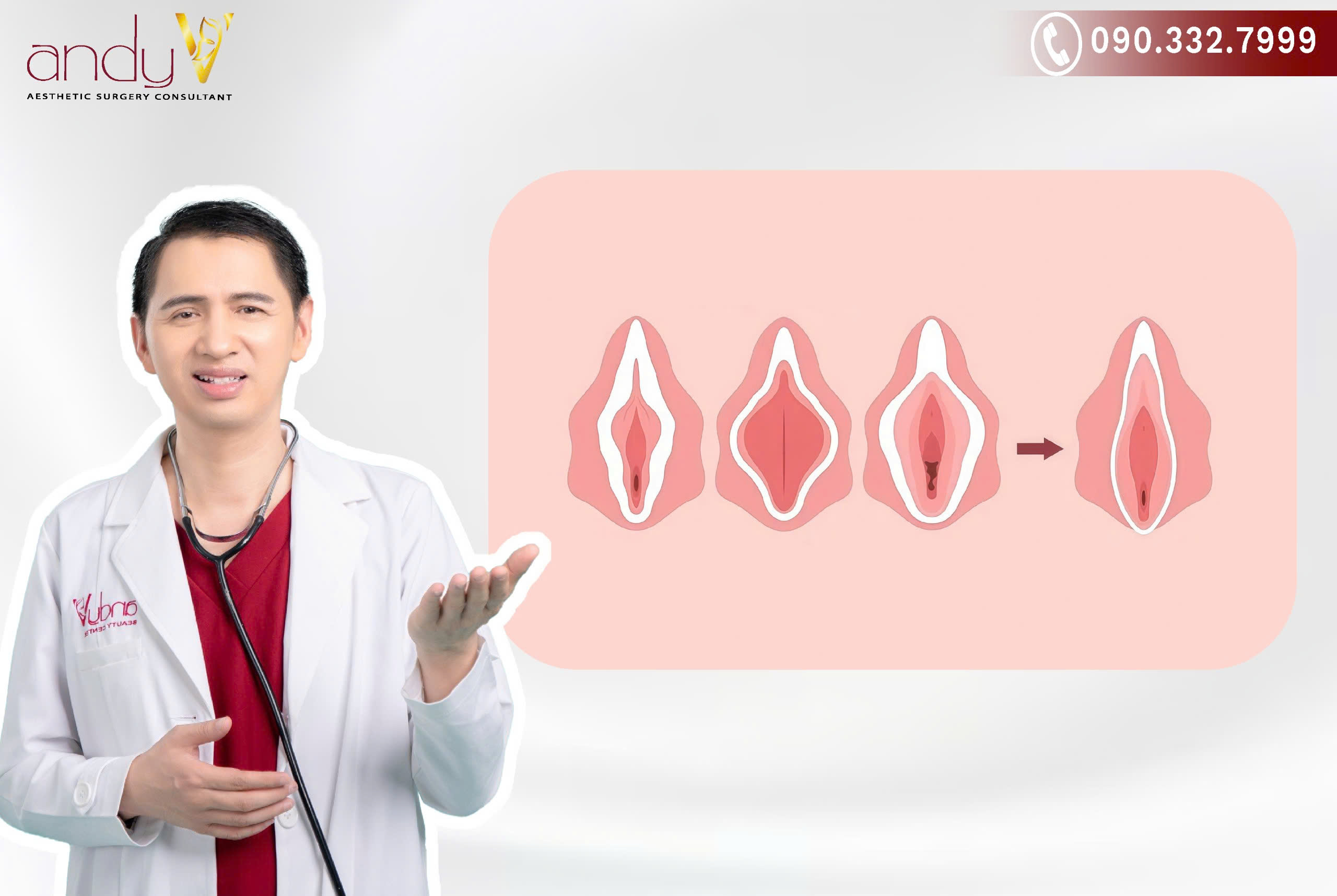 Có nên cắt môi bé khi chưa sinh con không?