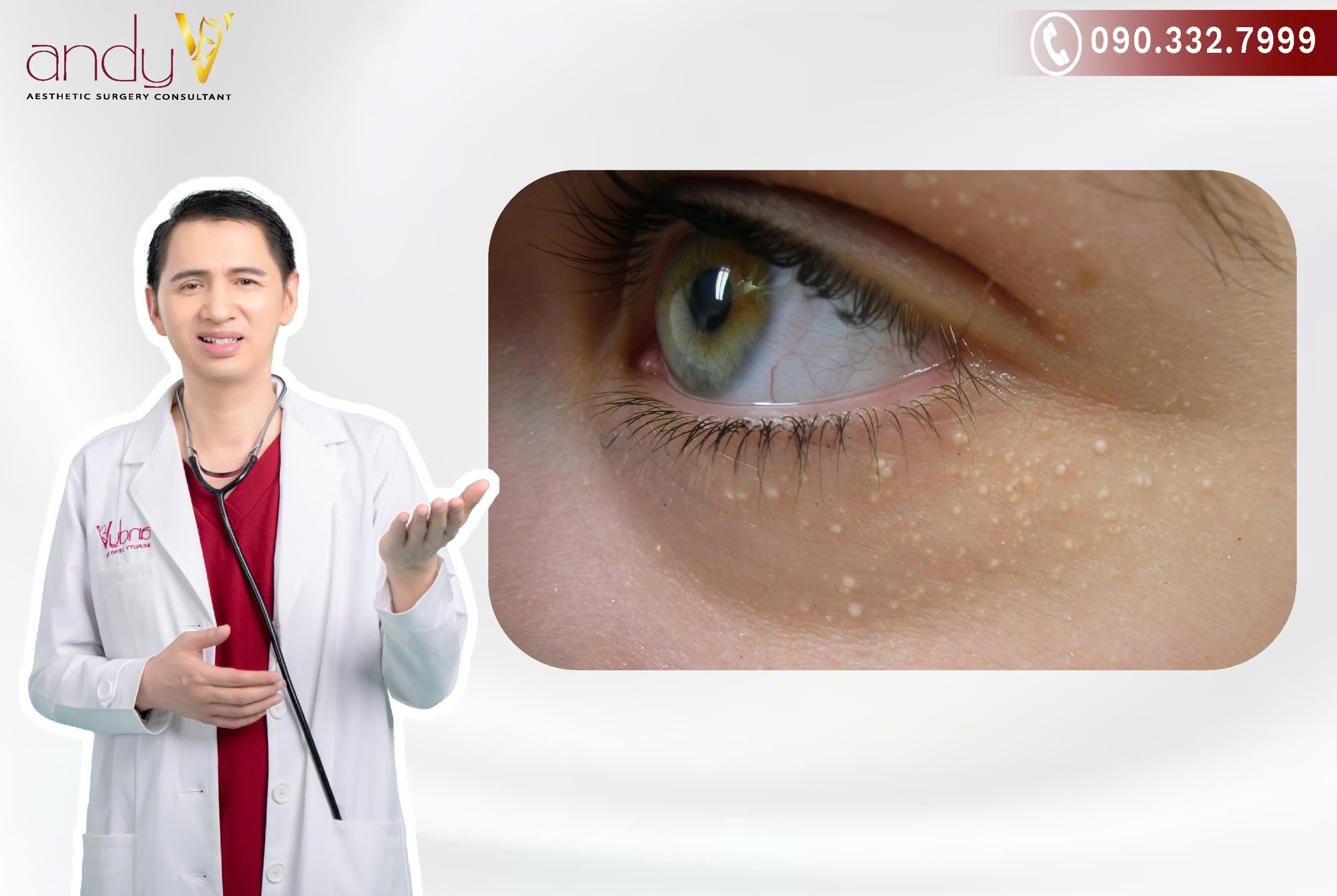 Nguyên nhân gây mụn gạo ở mặt